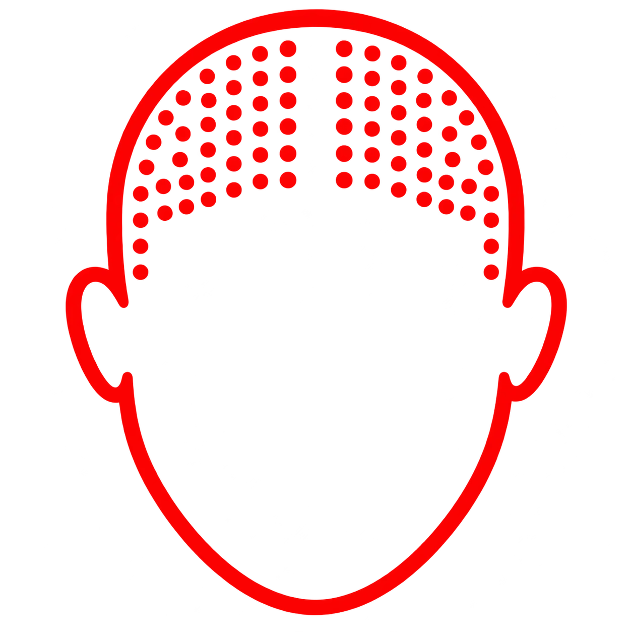 Alopecia