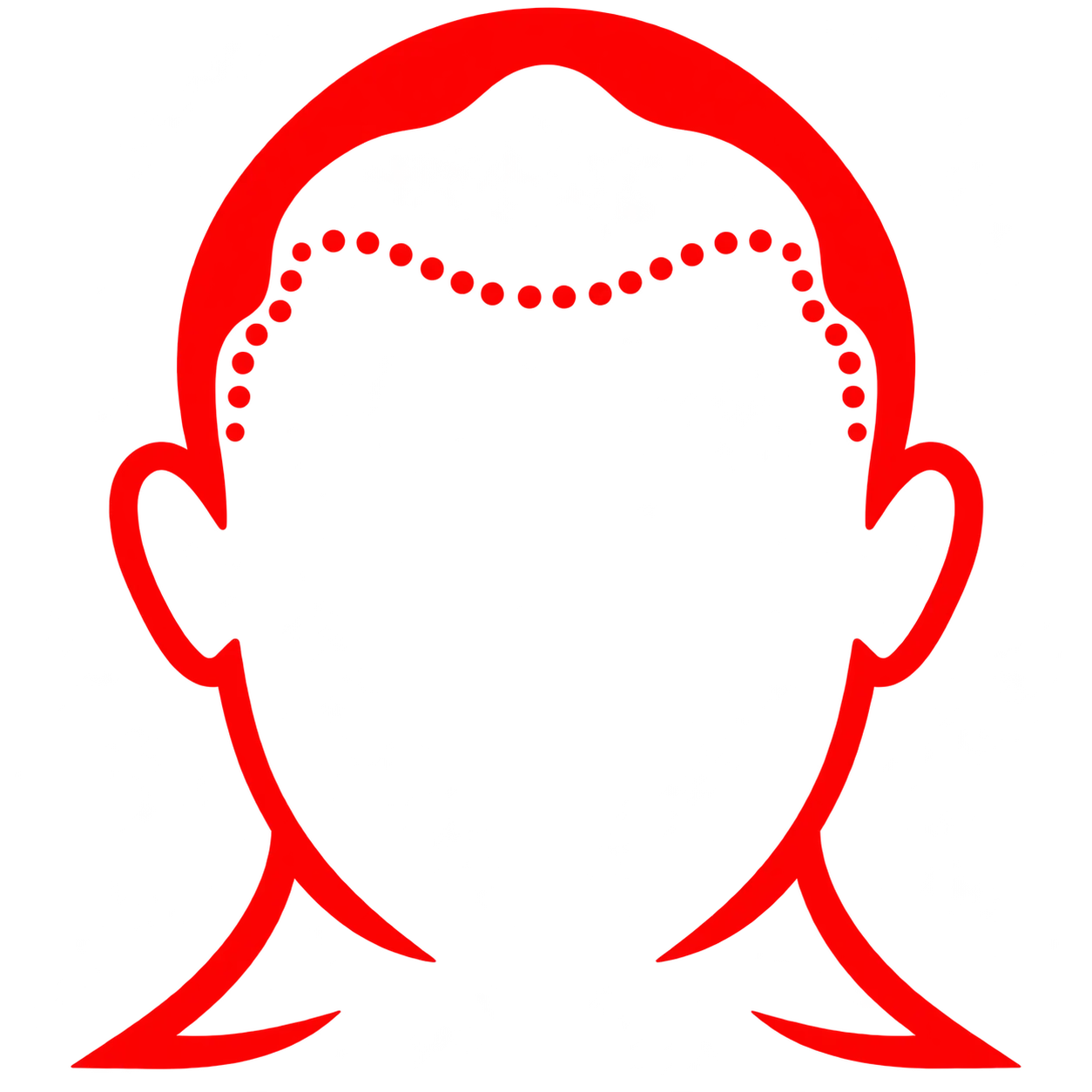 Receding Hairline