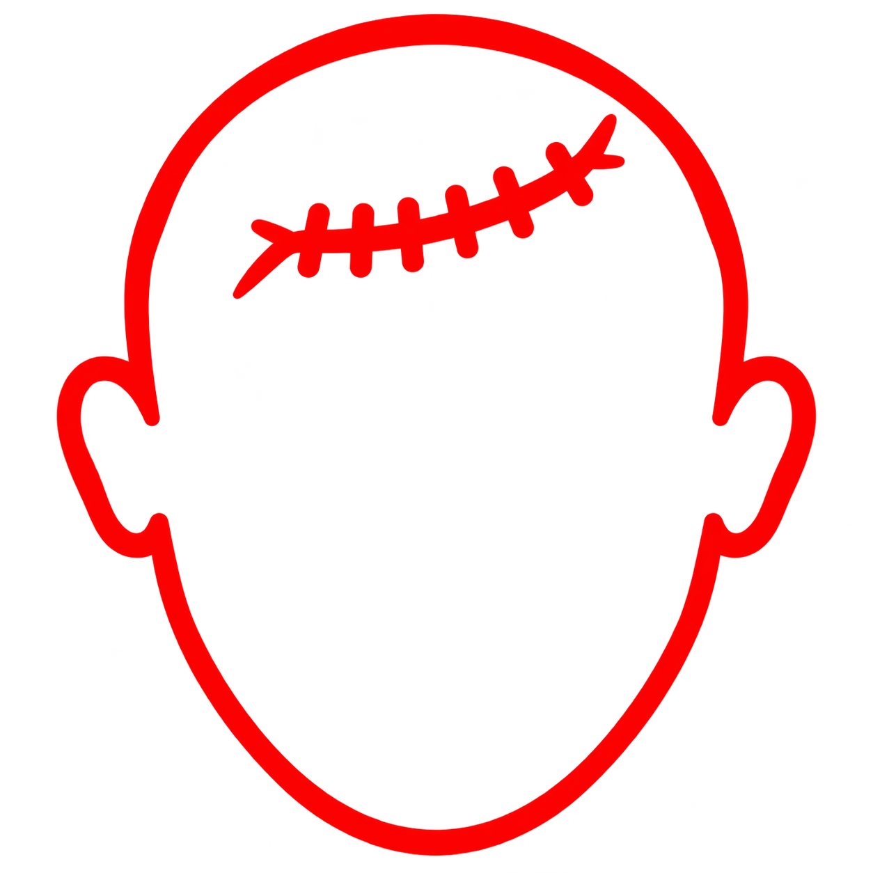 Hair Transplant Scars