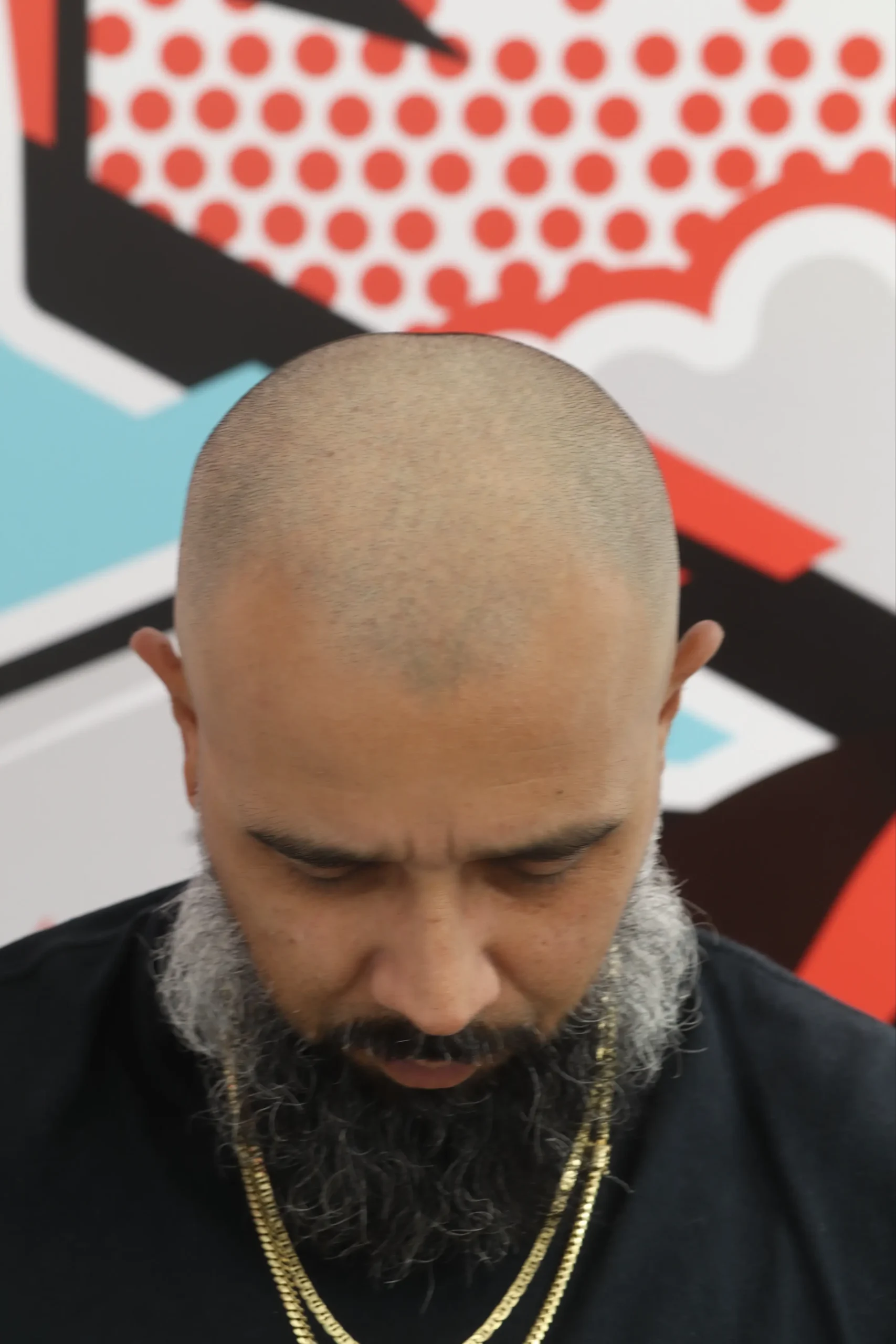 Density Fill before scalp micropigmentation