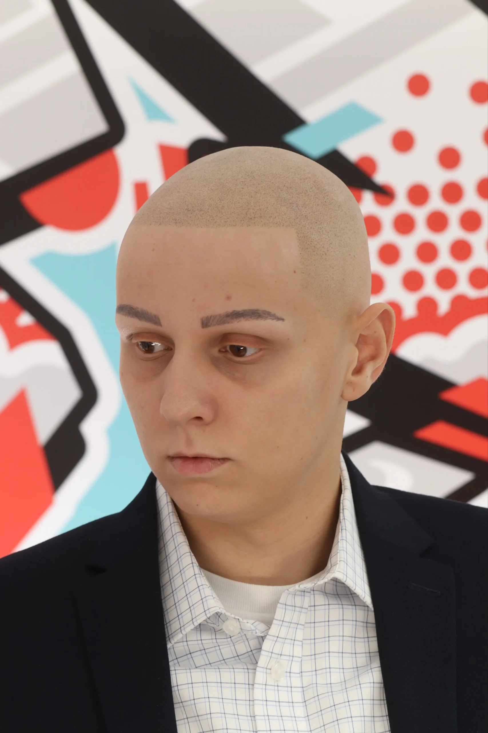 Full SMP after scalp micropigmentation